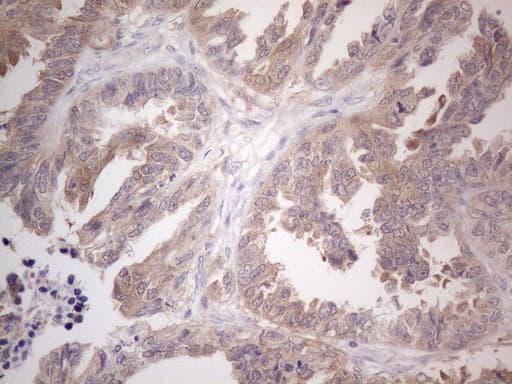 CAMK2B / CaMKII Beta Antibody (aa311-385, clone OTI8D9)