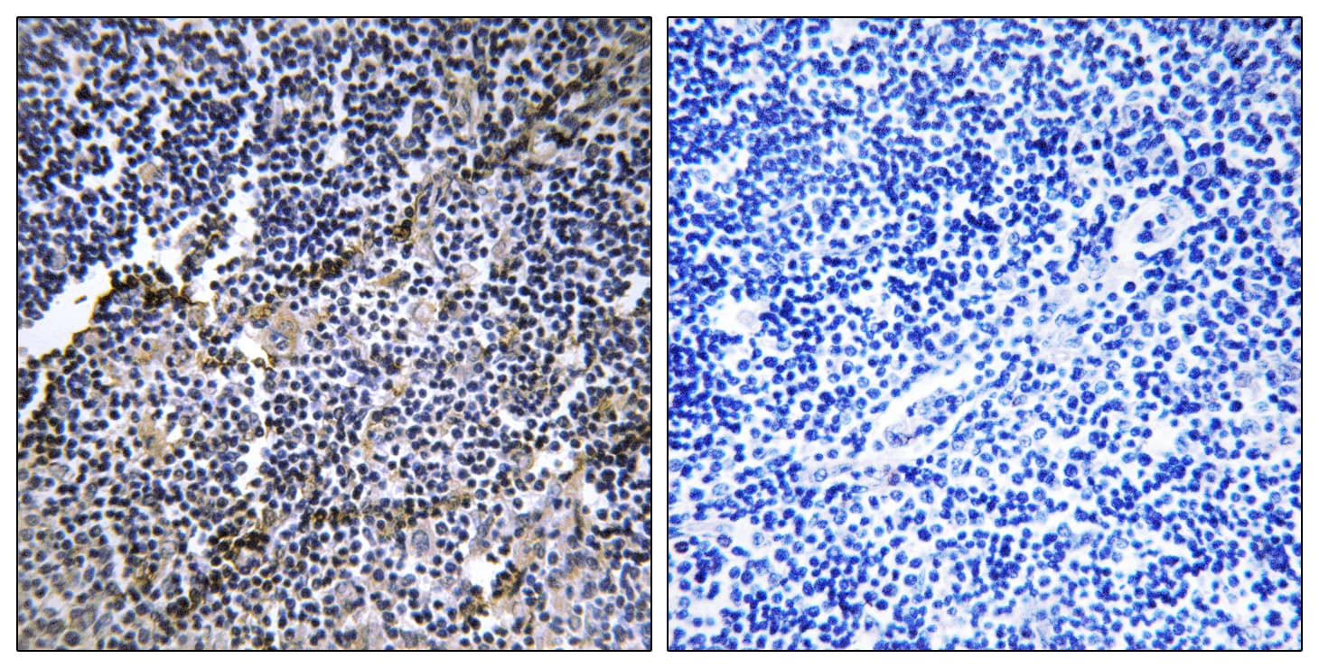 COL19A1 / Collagen XIX Antibody (aa421-470)