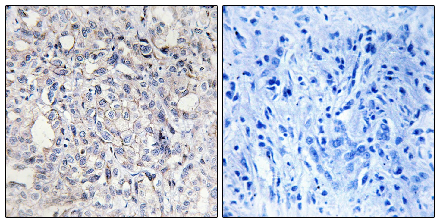 Polyclonal Rabbit anti-Human SERPIND1 / Heparin Cofactor 2 Antibody (aa41-90, IHC, IF)