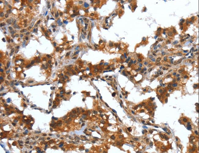 HNP-4 / DEFA4 Antibody