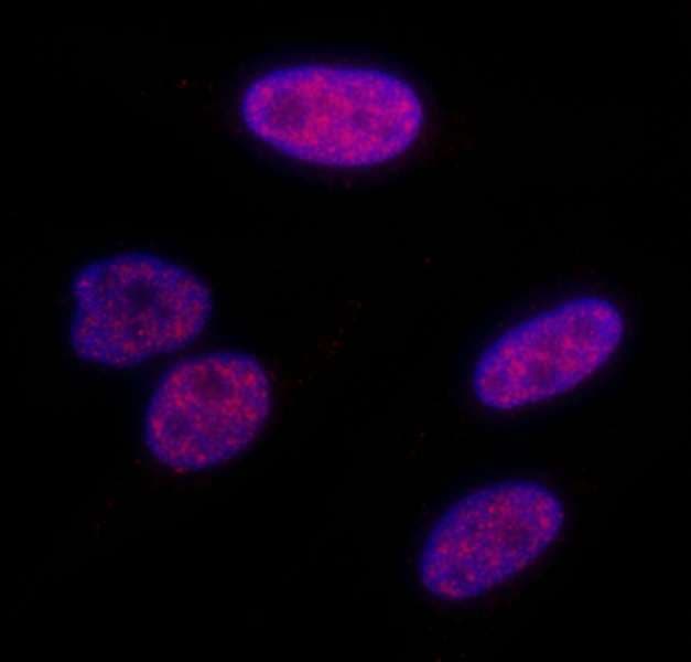 TRIM28 / KAP1 Antibody (phospho-Ser824)