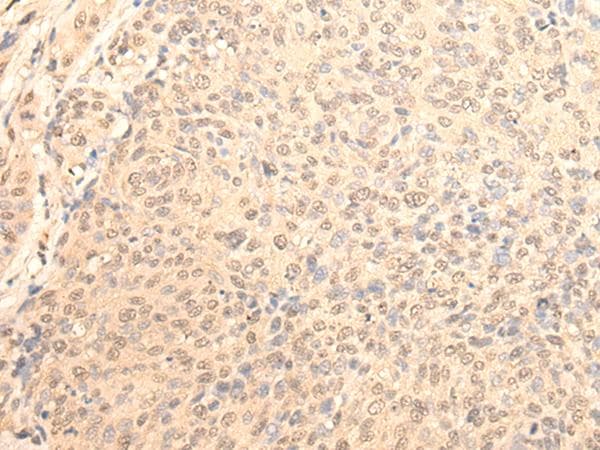 DAZ1 / DAZ Antibody