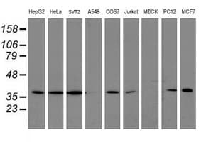 Monoclonal Mouse anti-Human LCMT1 Antibody (clone OTI2C9, IHC, WB)