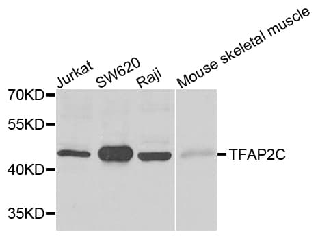 TFAP2C / AP2 Gamma Antibody (AP)