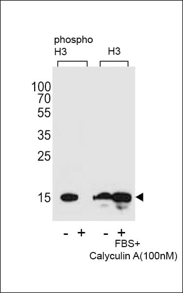 Polyclonal Rabbit anti-Human HIST1H3E Antibody (phospho-Ser10, IHC, WB)