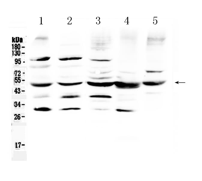 Polyclonal Rabbit anti-Human BAG5 Antibody (WB)
