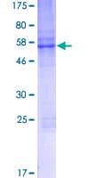 Human DPR2 / DACT2 Protein (Recombinant GST)