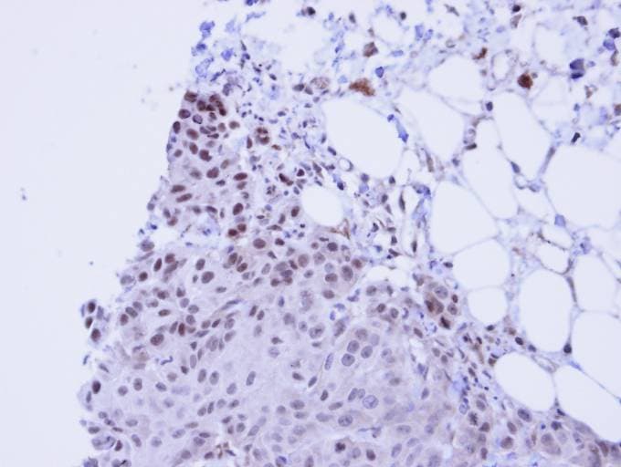 Polyclonal Rabbit anti-Human FACT / SSRP1 Antibody (aa75-338, IHC, WB)