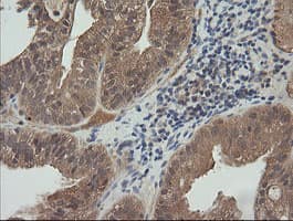 MAP2K3 / MEK3 / MKK3 Antibody (clone OTI5D3, Carrier-free)
