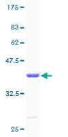 Human PCBD1 / PHS Protein (Recombinant GST)