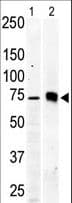 PRKCB / PKC-Beta Antibody (aa642-673)