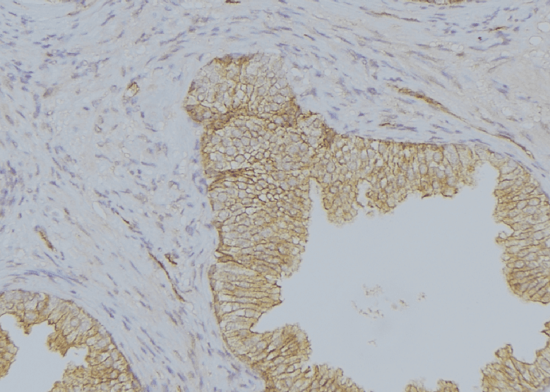 Polyclonal Rabbit anti-Human KRT19 / CK19 / Cytokeratin 19 Antibody (IHC, IF, WB)