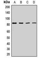 Polyclonal Rabbit anti-Human EXOC5 Antibody (WB)