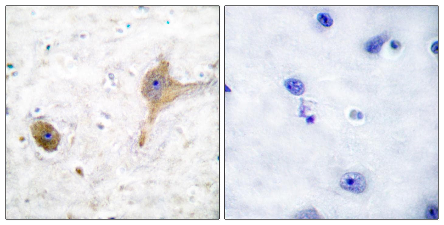 GABBR1 / GABA B Receptor 1 Antibody