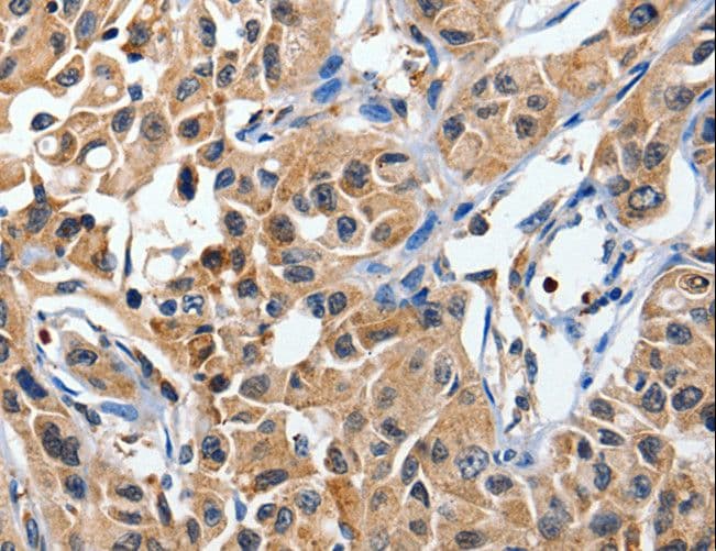 DUSP8 Antibody