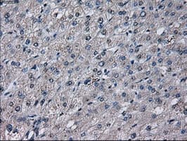 PRL / Prolactin Antibody (clone OTI11B11)