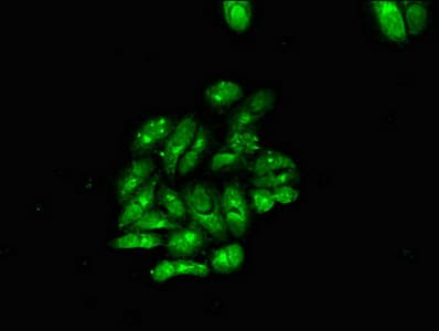 MBP / Myelin Basic Protein Antibody
