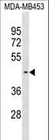 SUV39H2 Antibody (aa367-395)