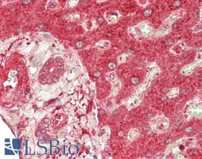 IHC-plus™ Polyclonal Goat anti-Human ADAMTS13 Antibody (aa150-200, IHC)
