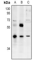 Polyclonal Rabbit anti-Human ZNF435 / ZSCAN16 Antibody (IHC, IF, WB)