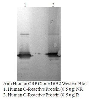 CRP / C-Reactive Protein Antibody
