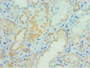 PARP3 Antibody (aa294-533)