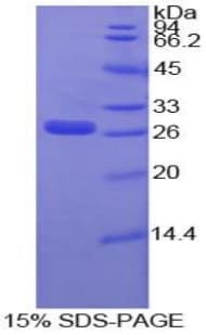 Human IGFBP4 Protein (Recombinant His)