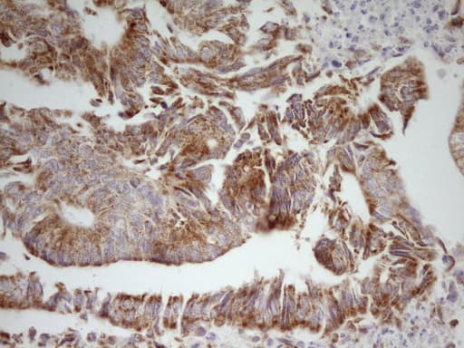 MRRF Antibody (aa56-262, clone OTI2A8)