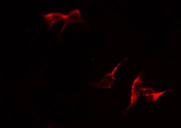 GPT2 / ALT2 Antibody