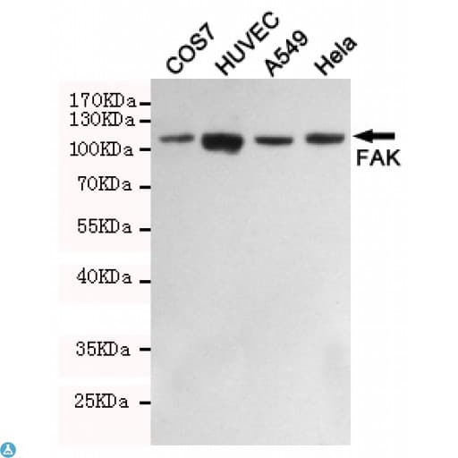 FAK / Focal Adhesion Kinase Antibody