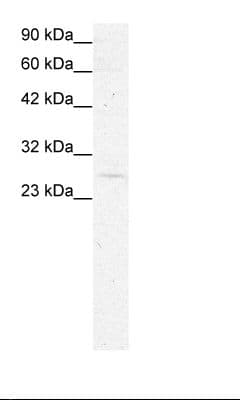 GAS41 Antibody (aa158-207)