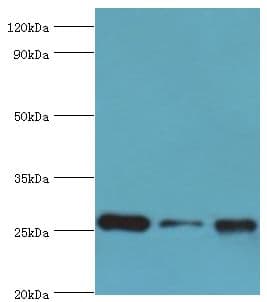 CLIC1 / NCC27 Antibody (aa42-241)