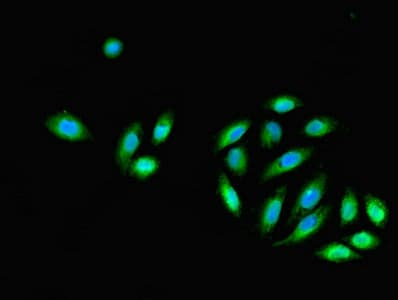Polyclonal Rabbit anti-Human DNALI1 Antibody (IHC, WB)