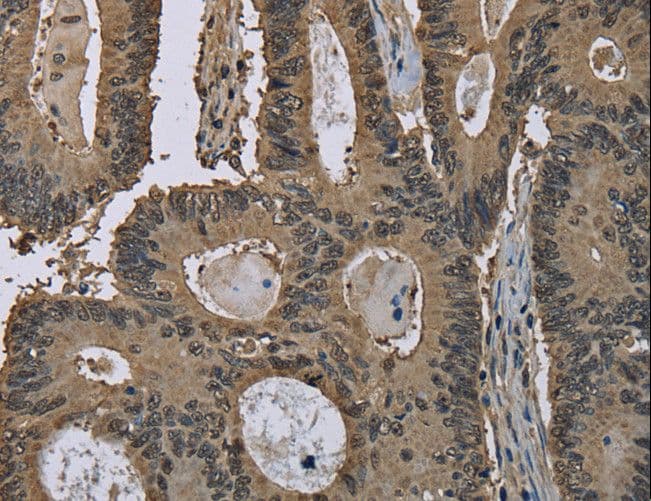 GSTP1 / GST Pi Antibody