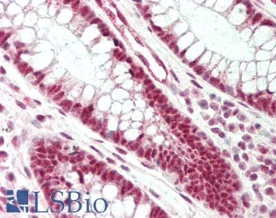 Polyclonal Rabbit anti-Rat SRRM1 Antibody (aa771-820, IHC, WB)