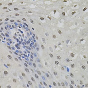 Polyclonal Rabbit anti-Human BSAC / MKL1 Antibody (IHC, WB)