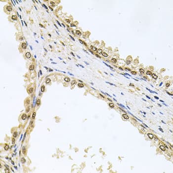 Polyclonal Rabbit anti-Human MCL1 / MCL 1 Antibody (IHC, IF, WB)