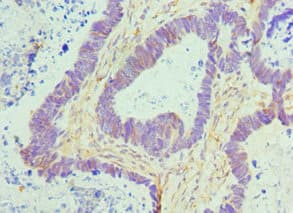 CTCF Antibody (aa1-260)