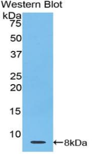 TMSB4X / Thymosin Beta-4 Antibody (aa1-44)