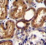 WT1 / Wilms Tumor 1 Antibody (aa346-375)