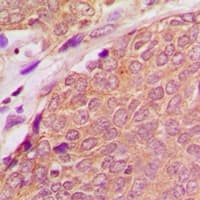 Polyclonal Rabbit anti-Human PYCARD / ASC / TMS1 Antibody (N-Terminus, IHC, IF, WB)