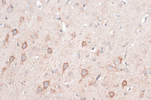 Polyclonal Rabbit anti-Human CD274 / B7-H1 / PD-L1 Antibody (IHC, IF, WB)