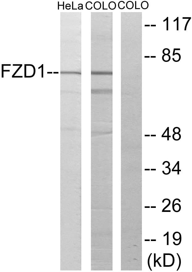 FZD1 / Frizzled 1 Antibody (aa15-64)
