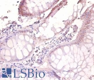 VAMP7 / SYBL1 / T1 VAMP Antibody (HRP)