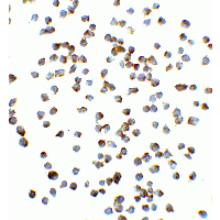 VCL / Vinculin Antibody
