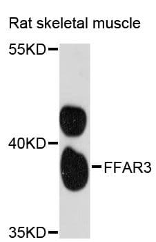 Polyclonal Rabbit anti-Human FFAR3 / GPR41 Antibody (WB)
