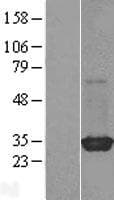 RIT2 / RIN Protein (Over-Expression Lysate Myc-DDK (Flag))