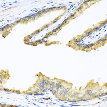 PathPlus™ Proenkephalin / PENK Antibody (aa 25-267)