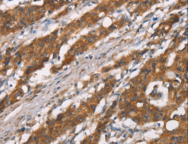 DSC2 / Desmocollin 2 Antibody