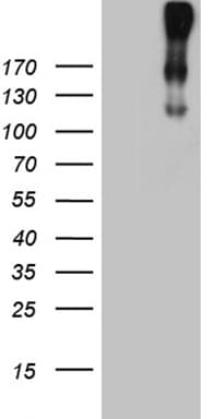 Monoclonal Mouse anti-Human CR1 / CD35 Antibody (clone OTI2A8, Carrier-free, aa1900-2039, IHC, WB)